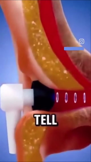 dbc029d7f9173d02.mp4